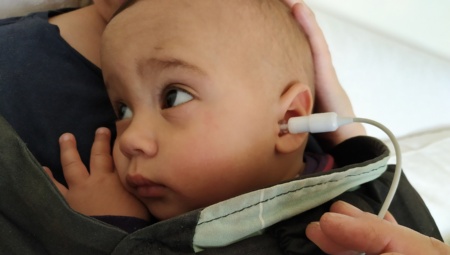 Die Fähigkeit zu hören ist einer unserer wertvollsten Sinne. Das Neugeborenen-Hörscreening mit Effizienz, Genauigkeit und Zuverlässigkeit ist daher besonders wichtig. ©Pathmedical