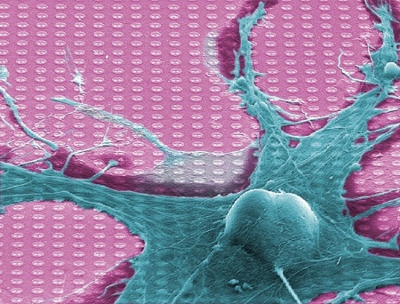 The "Neuro-Chip" from Infineon Technologies is connected with a living nerve cell. The Neuro-Chip's 16,384 sensors read the electrical activity of the cell. The typical size of neurons is between 10 - 50 micrometers (1 µm, a thousandth of a millimeter).    Press Photo: Infineon Technologies, Max Planck  Institute